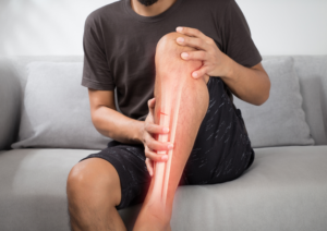 Le calcium pour éviter les fractures de fatigue