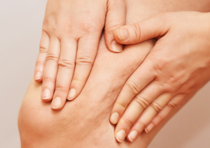 Mon alimentation anti-cellulite !