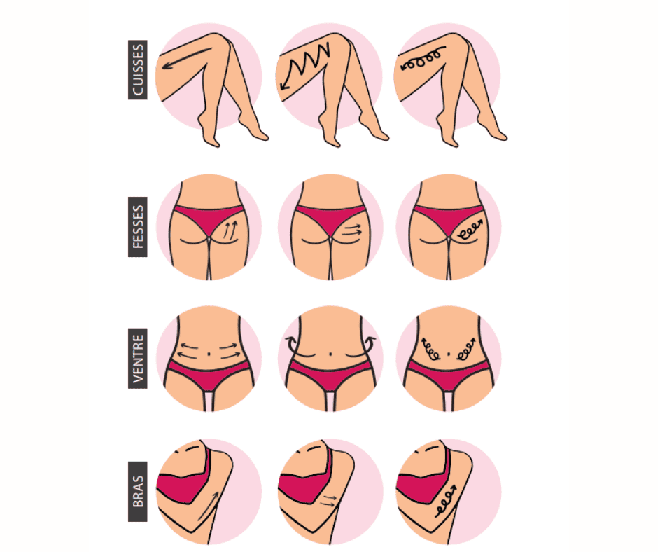 Article Cellulite - Mouvement ventouse